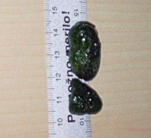 How Big are Gall Stones?