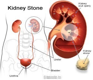 Kidney Size