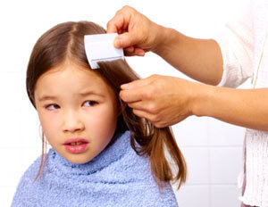 How Big are Head Lice?