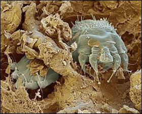 How Big are Scabies Mites?